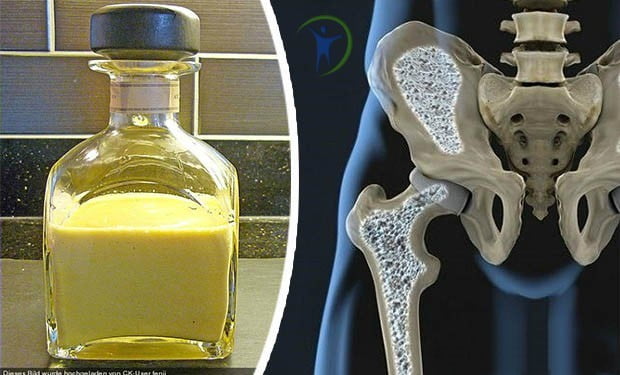  Remediu casnic- lichior de ou pentru osteoporoză și artrită