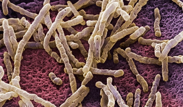  Simptomele candidozei intestinale sunt foarte frecvente și pot fi confundate cu simptomele altor boli. Iata 10 semne!