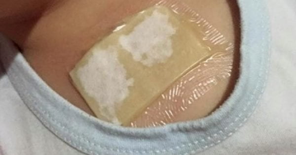  Compresa care  ameliorează rapid tusea severă și îndepărtează mucusul din plămâni și bronhii