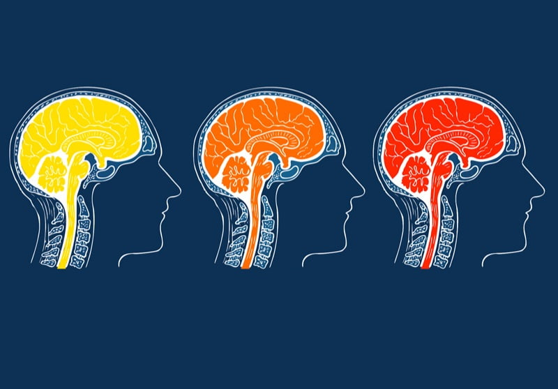  3 exerciții pentru creier pe care neurochirurgii îi sfătuiesc pe toți să le facă