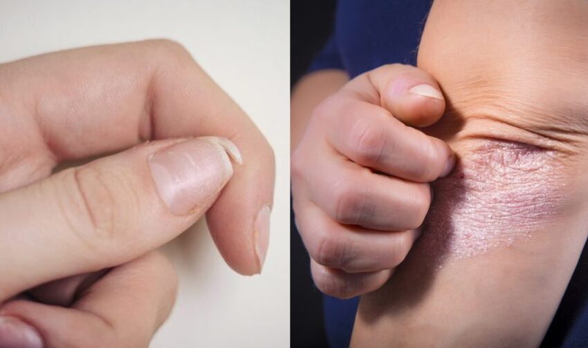  Când corpul cere ajutor: 10 „clopote” care indică faptul că nu suntem la fel de sănătoși pe cât credem