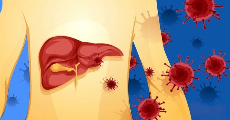  9 semne că ficatul este plin de toxine