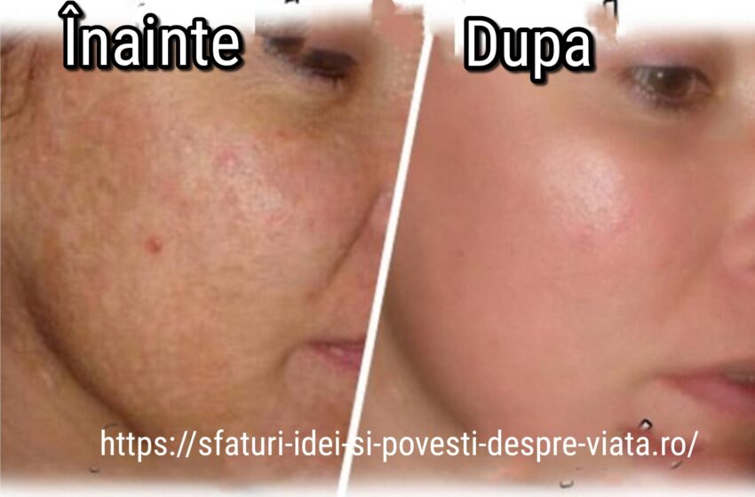  Elimină petele, ridurile, cearcănele de pe față și cosurile ca nimeni altcineva