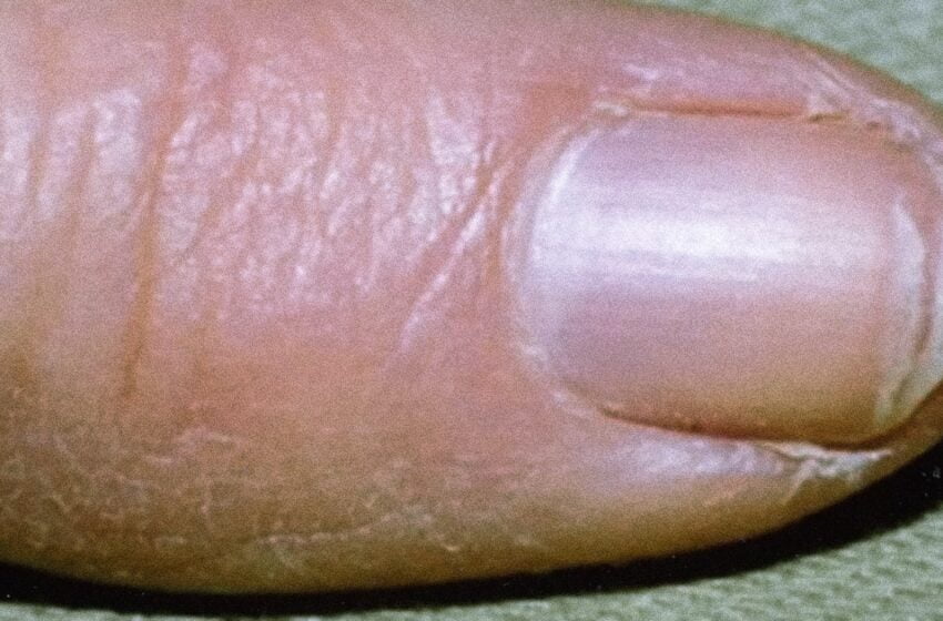  Aveți unghii uscate și fragile, iar somnul nu va este usor?Pregătiți un amestec care să  îmbunătățească rapid starea