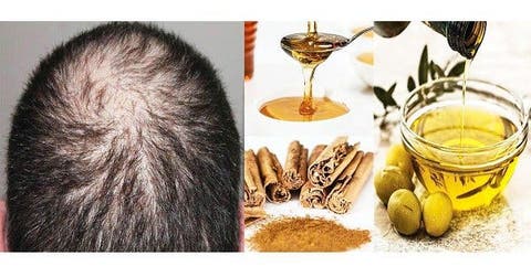  Un remediu natural pentru a opri căderea părului, a-l întări și a accelera creșterea lui