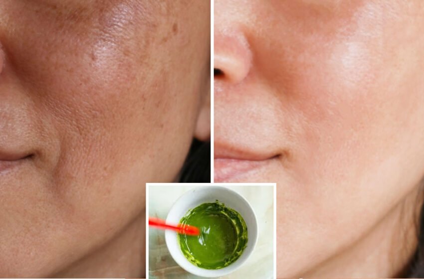  Mască de pătrunjel împotriva ridurilor, acneei și petelor pielii