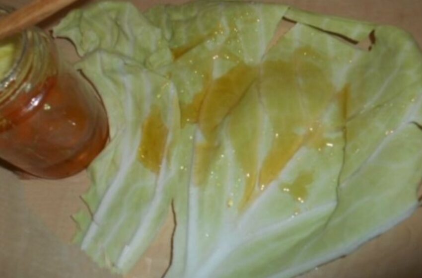  Cum se vindecă tusea persistentă și bronșita cu frunze de varză și miere