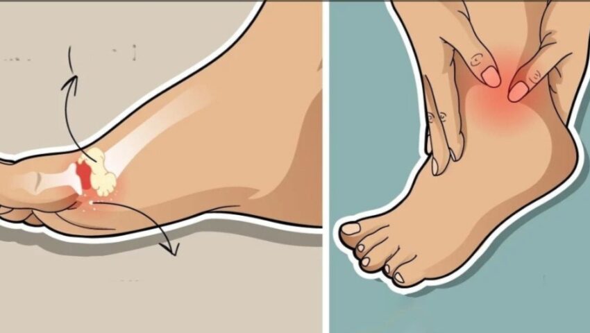  8 alimente care pot reduce acidul uric din organism