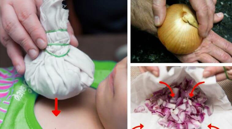  Un remediu antic cu lămâie și ceapă pentru tratarea astmului bronșic, a bronșitei și a bolilor cronice pulmonare