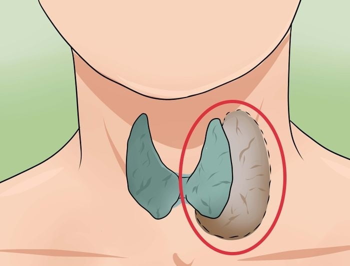  Tulburările tiroidiene sunt prevenibile! Recunoașteți simptomele în timp și acționați!