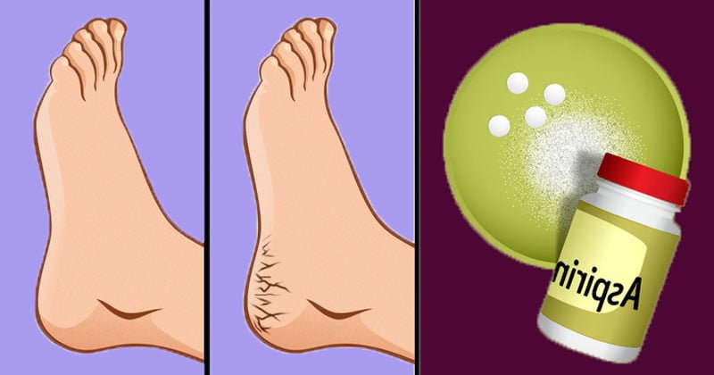  5 metode naturale pe care le puteți aplica cu ușurință acasă