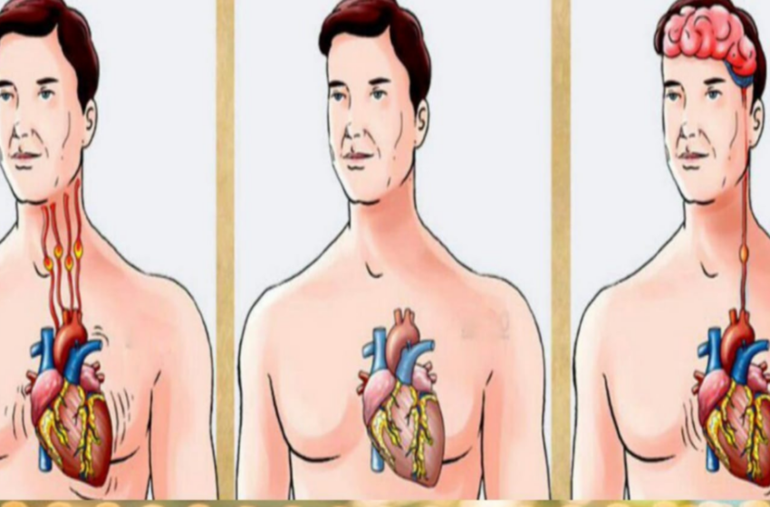  Trebuie să cunoașteți diferențele dintre un infarct, un stop cardiac și un accident vascular cerebral
