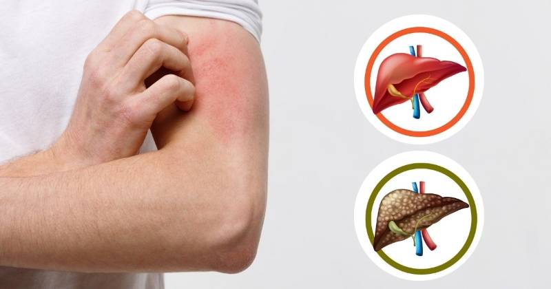  Corpul nostru încearcă să ne avertizeze când ficatul este plin de toxine, trebuie doar să fim atenți la semne!