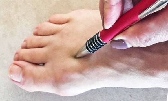  Reduceți tensiunea arterială ridicată în 10 secunde