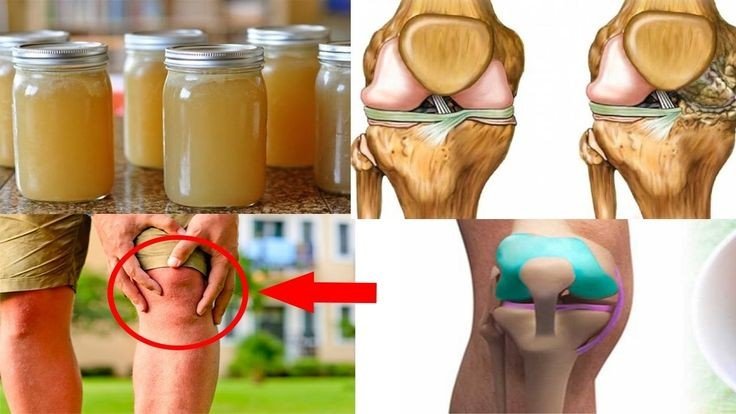  Acest sirop ușor de făcut, reface oasele și îndepărtează durerile articulare