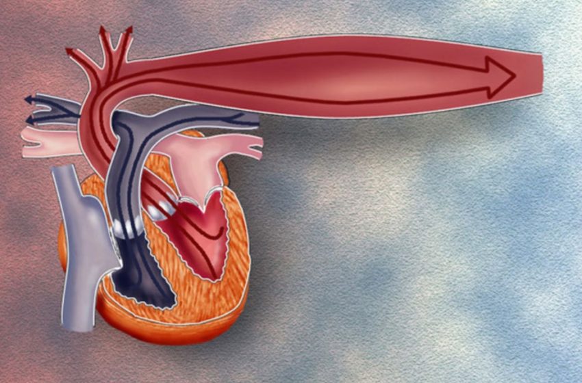  Cum se controlează hipertensiunea arterială: Remedii casnice.