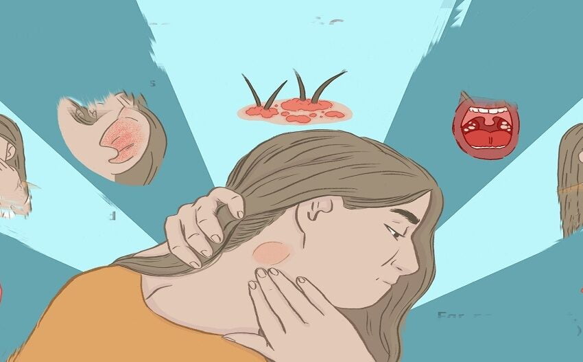  Ganglioni limfatici umflați: simptome și modalități de a le preveni