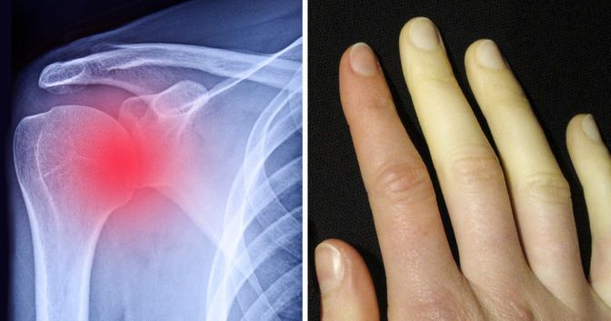  10 semnale din corpurile noastre care trebuie luate în serios