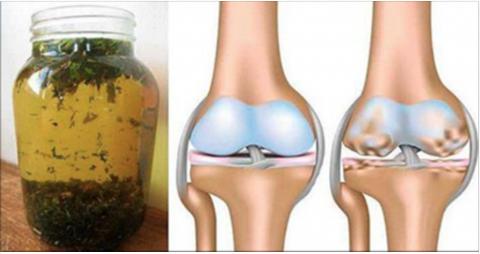  Elimina durerile articulare si musculare cu acest remediu antiinflamator din plante!