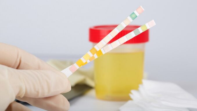  Cum puteți detecta de acasă cu ușurință boli și complicații de sănătate