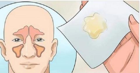  Cum să elimini congestia nazală în câteva minute fără a folosi medicamente!