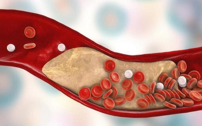  Arterele înfundate la picioare? Aflați imediat cu un test făcut acasă!