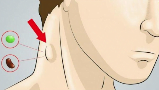  Limfa se numește apa vie a corpului. Acesta circulă prin canalele limfatice, spălând întregul corp.10 moduri ușoare de a vă curăța sistemul limfatic