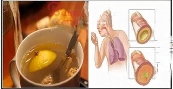  Rețetă de casă pentru tuse și pneumonie: funcționează mai repede decât orice sirop pentru tuse