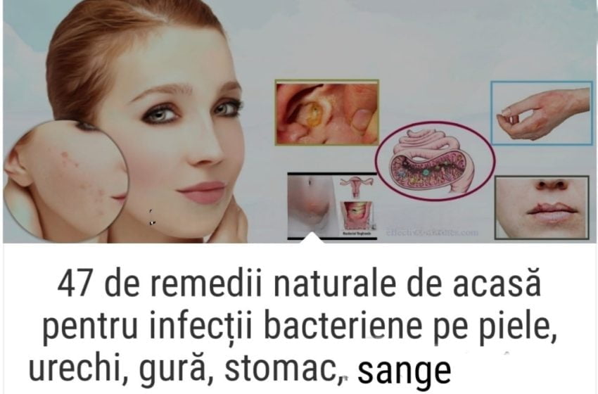  47 de remedii naturale de acasă pentru infecții bacteriene pe piele, urechi, gură, stomac, sânge