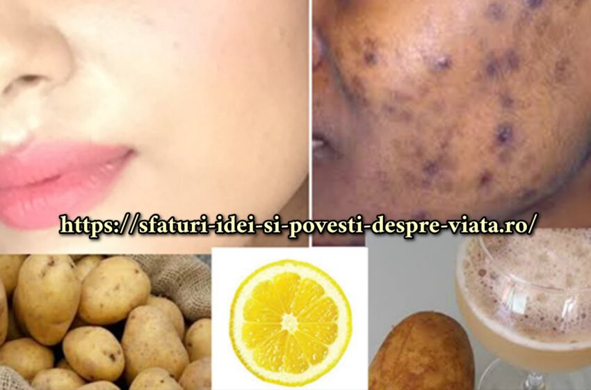  Scapa de acnee, pete negre,si cicatrici faciale natural și simplu!