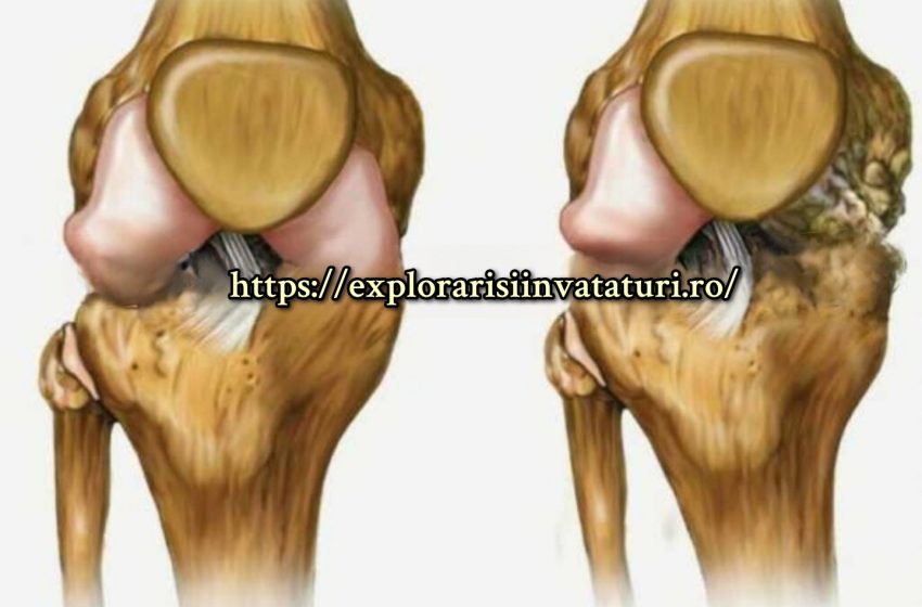  Cea mai populară rețetă din lume! Îți vindecă genunchii, restabilește oasele și articulațiile în cel mai scurt timp!