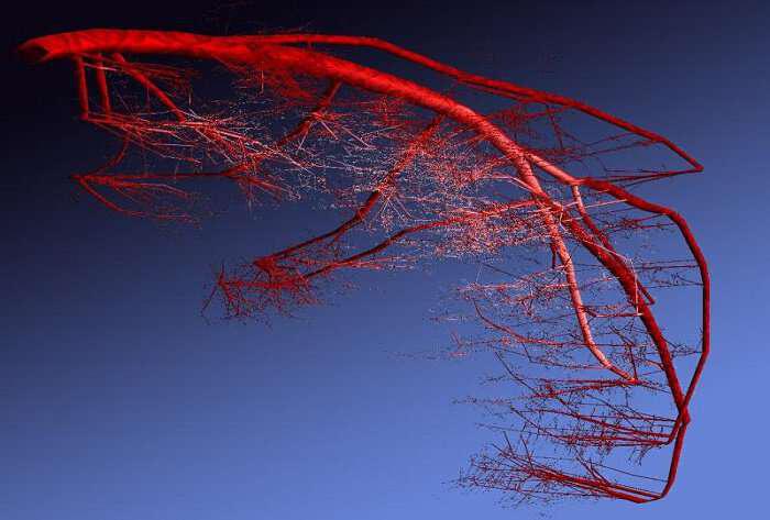  4 semne care…,,strigă „că arterele tale sunt blocate