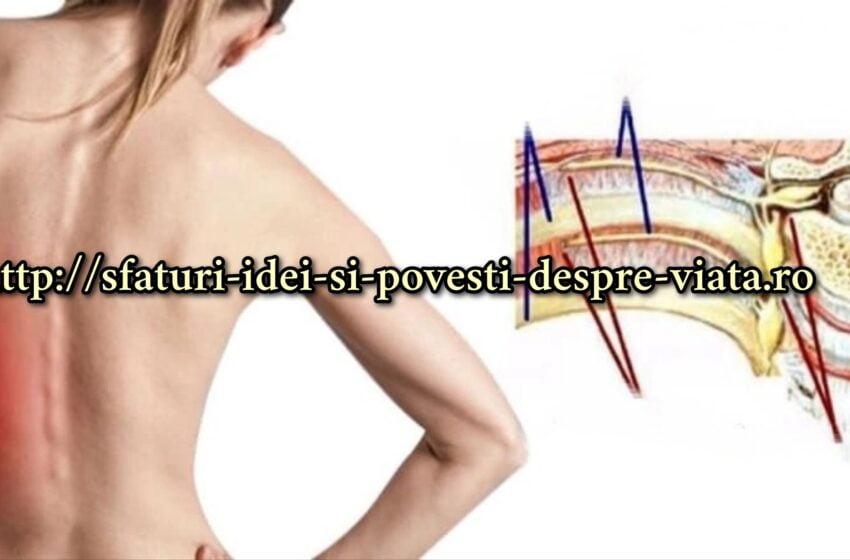  Tratăm nevralgia intercostală natural (durere de spate și piept)