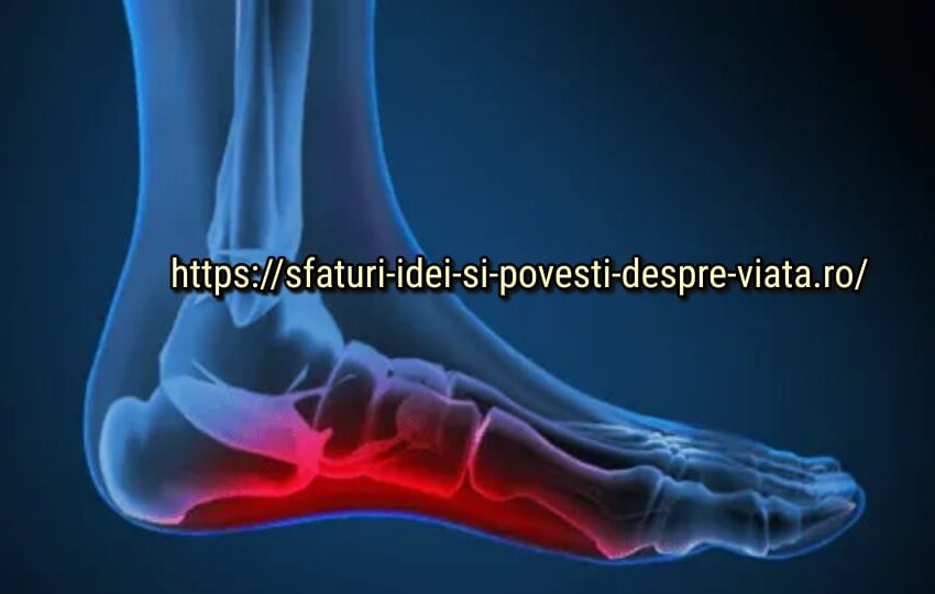 Remedii naturale pentru fasciita plantară (călcâiul de jogger)