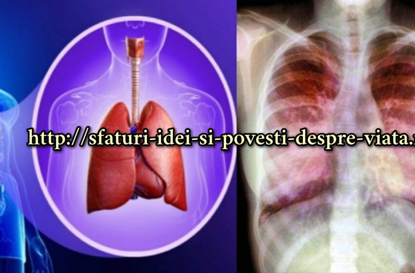  Fibroza chistică: Ce este și ce organe afectează – Cauze, simptome