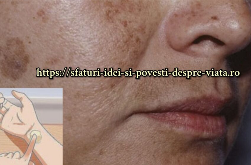  Acest remediu   neutralizează petele, pistruii, ridurile și chiar ameliorează pielea lăsată. 