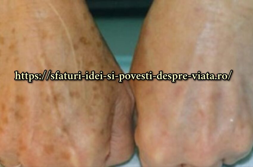  Unguent de casă ieftin pentru maini, petele și crăpăturile vor dispărea+ o rețetă care îți va întări unghiile și genunchii