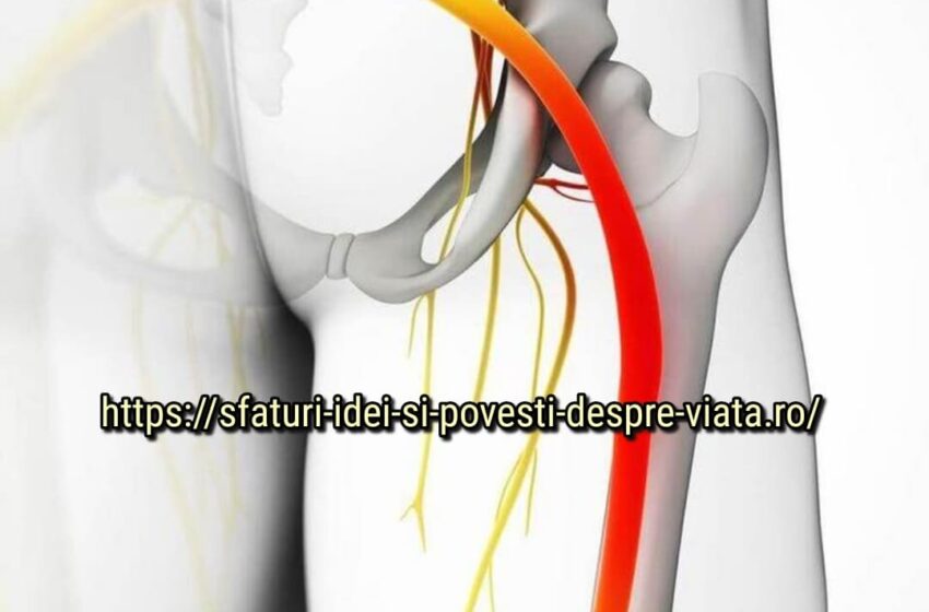  Nervul sciatic ciupit: 5 moduri de a ameliora durerea