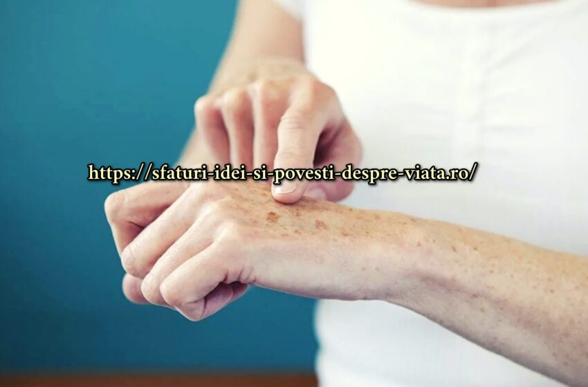  Cum să luminezi petele de vârstă de pe mâini. 2 retete simple 