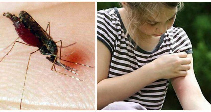  Tratamentul mușcăturilor de insecte cu remedii populare.Simptome și tratament