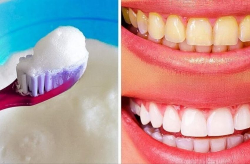  Cum să vă albiți dinții acasă într-un mod natural