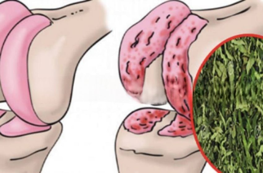  Un remediu simplu pentru repararea cartilajului din genunchi, articulații și pentru întărirea oaselor!