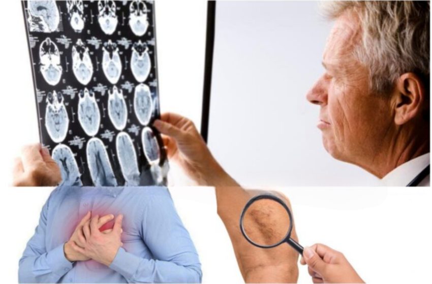  Boli vasculare: simptome, diagnostic, prevenire,posibile complicatii