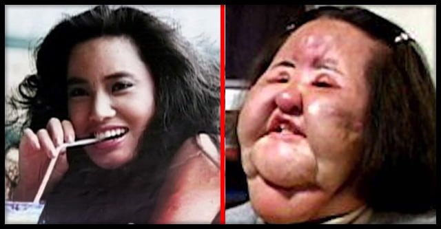  8 exemple de ceea ce se întâmplă când vrei sa devii prea frumos și devii victima unui cosmetician fără experienta