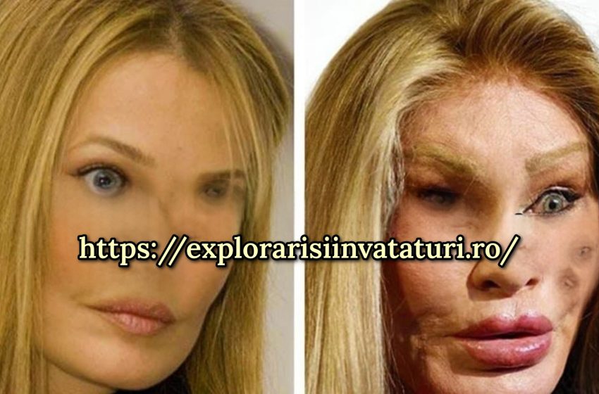  10 femei frumoase care și-au distrus frumusețea cu operații plastice