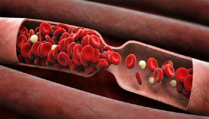  7 alimente care subțiază sângele. Aflați cum să preveniți formarea cheagurilor și să trăiți mai mult