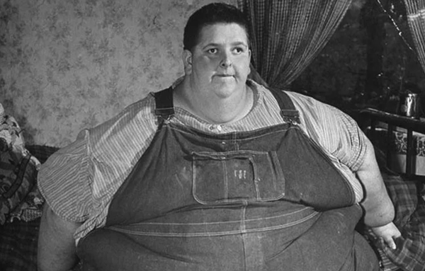  Record de 634 de kilograme, sau cea mai grasă persoană de pe planetă