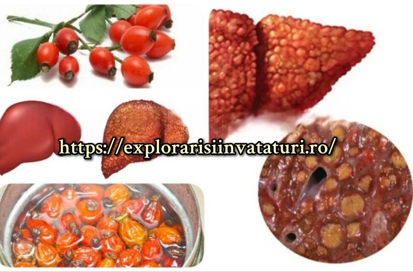  Măceșul va învinge ciroza hepatică și va elimina bila dintr-o singură lovitură!