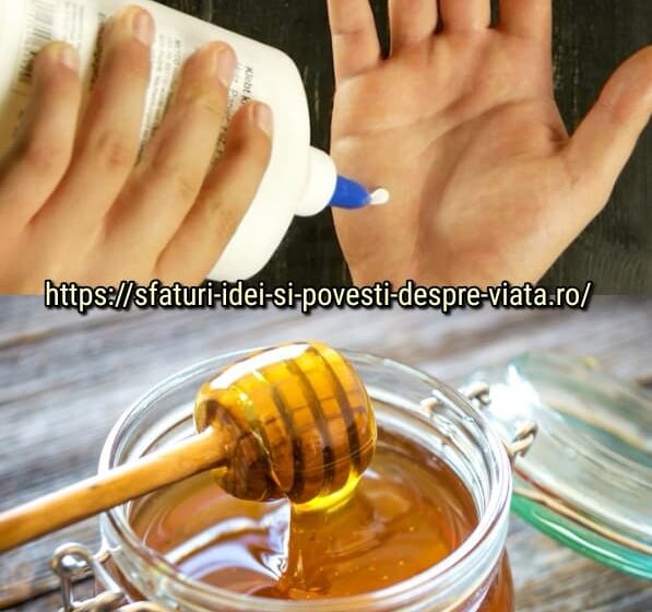  8 remedii uimitoare de casă pentru dureri de cap, vânătăi și arsuri.