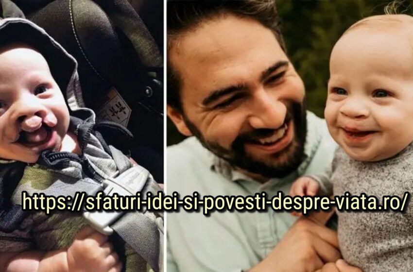  Un tată a împărtășit povestea fiului său după ce un prieten a comentat că un copil cu buză despicată ar trebui abandonat